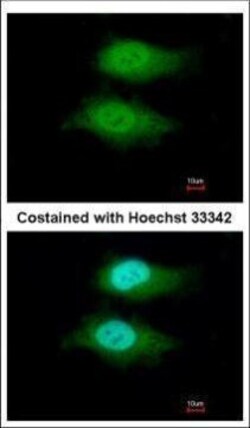 Invitrogen VWA5A Polyclonal Antibody 100 &mu;L; Unconjugated:Antibodies,