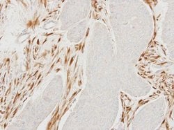Invitrogen MOCS2 Polyclonal Antibody 100 &mu;L | Buy Online | Invitrogen&trade; | Fisher Scientific