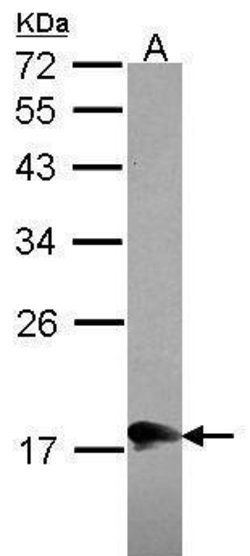 Invitrogen MOCS2 Polyclonal Antibody 100 &mu;L | Buy Online | Invitrogen&trade; | Fisher Scientific