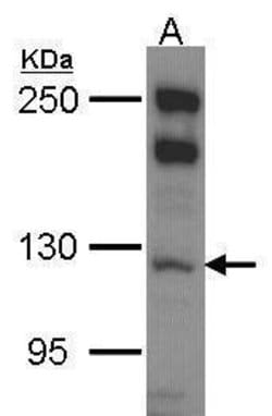 Invitrogen MYO1B Polyclonal Antibody 100 &mu;L; Unconjugated:Antibodies,