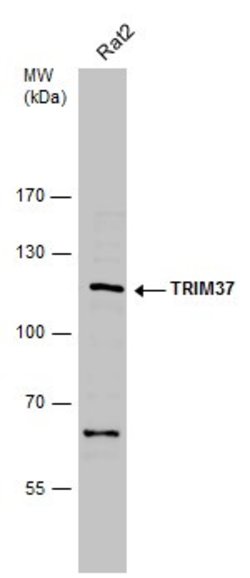 Invitrogen TRIM37 Polyclonal Antibody 100 &mu;L; Unconjugated:Antibodies,