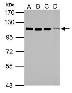 Invitrogen TRIM37 Polyclonal Antibody 100 &mu;L; Unconjugated:Antibodies,