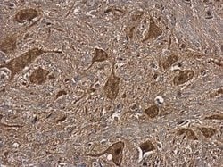 Invitrogen NAGLU Polyclonal Antibody 100 &mu;L | Buy Online | Invitrogen&trade; | Fisher Scientific