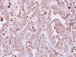 Invitrogen NAGLU Polyclonal Antibody 100 &mu;L | Buy Online | Invitrogen&trade; | Fisher Scientific