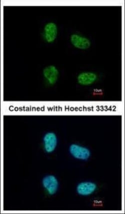 Invitrogen NCBP1 Polyclonal Antibody 100 &mu;L; Unconjugated:Antibodies,