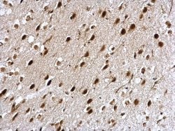Invitrogen NCBP1 Polyclonal Antibody 100 &mu;L; Unconjugated:Antibodies,