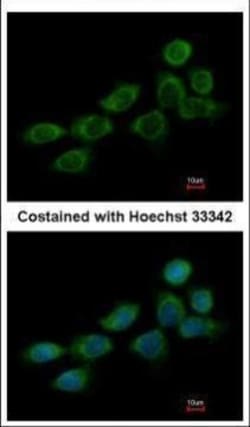 Invitrogen NDUFB10 Polyclonal Antibody 100 &mu;L; Unconjugated:Antibodies,