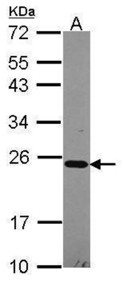 Invitrogen NDUFB10 Polyclonal Antibody 100 &mu;L; Unconjugated:Antibodies,