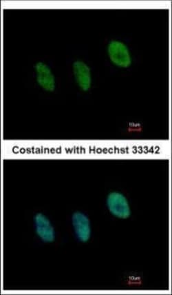 Invitrogen NFYB Polyclonal Antibody 100 &mu;L | Buy Online | Invitrogen&trade; | Fisher Scientific