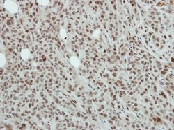 Invitrogen NFYB Polyclonal Antibody 100 &mu;L; Unconjugated:Antibodies,