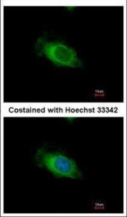 Invitrogen Nardilysin Polyclonal Antibody 100 &mu;L | Buy Online | Invitrogen&trade; | Fisher Scientific
