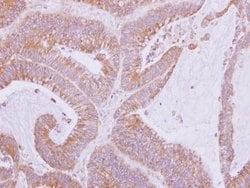 Invitrogen Nardilysin Polyclonal Antibody 100 &mu;L | Buy Online | Invitrogen&trade; | Fisher Scientific