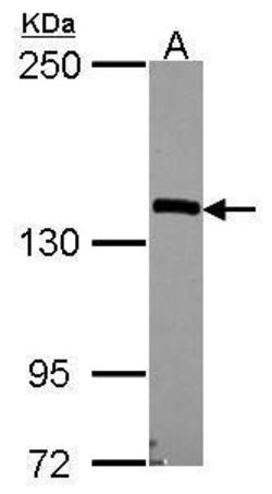 Invitrogen Nardilysin Polyclonal Antibody 100 &mu;L | Buy Online | Invitrogen&trade; | Fisher Scientific