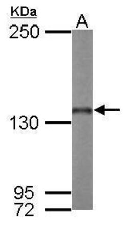 Invitrogen Nardilysin Polyclonal Antibody 100 &mu;L | Buy Online | Invitrogen&trade; | Fisher Scientific