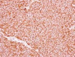 P2X5 Polyclonal Antibody, Invitrogen 100 &mu;L; Unconjugated:Antibodies,