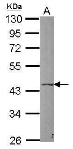 P2X5 Polyclonal Antibody, Invitrogen 100 &mu;L; Unconjugated:Antibodies,
