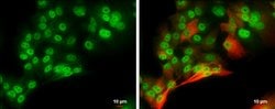 Invitrogen&trade;&nbsp;POU3F2 Polyclonal Antibody
