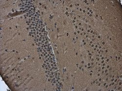 Invitrogen POU3F2 Polyclonal Antibody 100 &mu;L | Buy Online | Invitrogen&trade; | Fisher Scientific