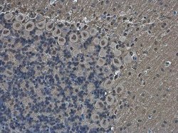 Invitrogen POU3F2 Polyclonal Antibody 100 &mu;L | Buy Online | Invitrogen&trade; | Fisher Scientific