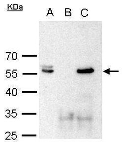 Invitrogen POU3F2 Polyclonal Antibody 100 &mu;L | Buy Online | Invitrogen&trade; | Fisher Scientific