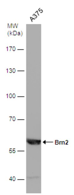 Invitrogen POU3F2 Polyclonal Antibody 100 &mu;L | Buy Online | Invitrogen&trade; | Fisher Scientific
