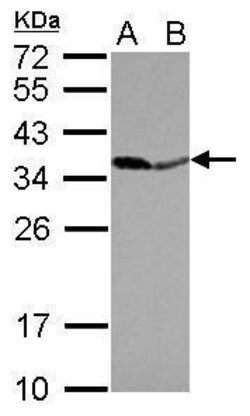 Invitrogen PPA1 Polyclonal Antibody 100 &mu;L; Unconjugated:Antibodies,