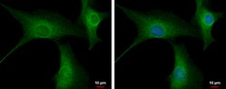 Invitrogen PPP2R3A Polyclonal Antibody 100 &mu;L; Unconjugated:Antibodies,
