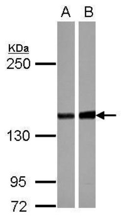 Invitrogen PPP2R3A Polyclonal Antibody 100 &mu;L; Unconjugated:Antibodies,