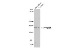 Invitrogen PPP2R3A Polyclonal Antibody 100 &mu;L; Unconjugated:Antibodies,