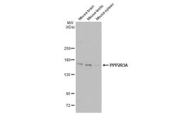 Invitrogen PPP2R3A Polyclonal Antibody 100 &mu;L; Unconjugated:Antibodies,