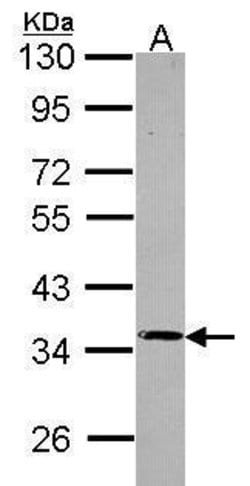 Invitrogen PPP4C Polyclonal Antibody 100 &mu;L; Unconjugated:Antibodies,