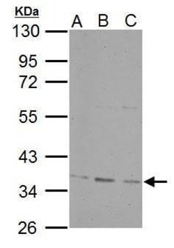 Invitrogen PPP4C Polyclonal Antibody 100 &mu;L; Unconjugated:Antibodies,