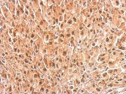 Invitrogen PSMC4 Polyclonal Antibody 100 &mu;L; Unconjugated:Antibodies,