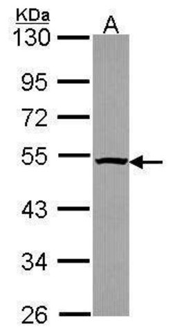 Invitrogen PSMC4 Polyclonal Antibody 100 &mu;L; Unconjugated:Antibodies,