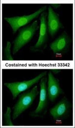 Invitrogen PSMC5 Polyclonal Antibody 100 &mu;L; Unconjugated:Antibodies,