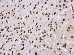 Invitrogen PSMC5 Polyclonal Antibody 100 &mu;L; Unconjugated:Antibodies,