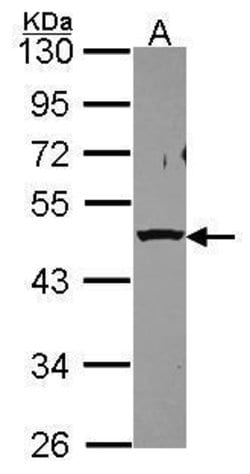 Invitrogen PSMC5 Polyclonal Antibody 100 &mu;L; Unconjugated:Antibodies,
