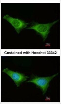 Invitrogen PSMC6 Polyclonal Antibody 100 &mu;L | Buy Online | Invitrogen&trade; | Fisher Scientific