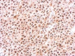 Invitrogen PSMC6 Polyclonal Antibody 100 &mu;L; Unconjugated:Antibodies,