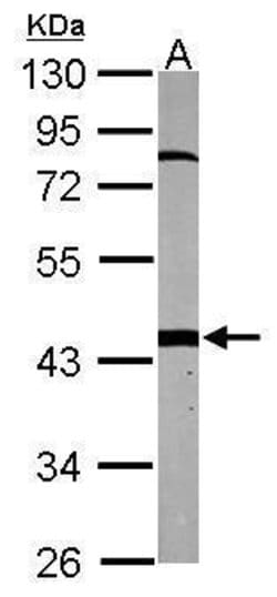 Invitrogen PSMC6 Polyclonal Antibody 100 &mu;L; Unconjugated:Antibodies,