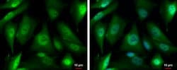 Invitrogen PSMD4 Polyclonal Antibody 100 &mu;L; Unconjugated:Antibodies,