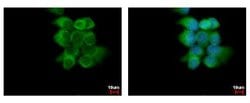 Invitrogen ABCD4 Polyclonal Antibody 100 &mu;L; Unconjugated:Antibodies,