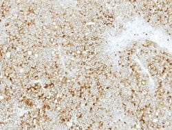 Invitrogen ABCD4 Polyclonal Antibody 100 &mu;L; Unconjugated:Antibodies,
