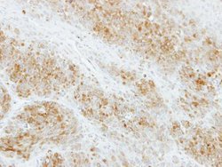 RAB2A Polyclonal Antibody, Invitrogen 100 &mu;L; Unconjugated:Antibodies,