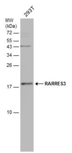 Invitrogen RARRES3 Polyclonal Antibody 100 &mu;L; Unconjugated:Antibodies,
