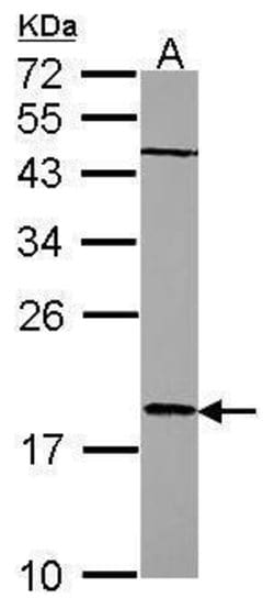 Invitrogen RARRES3 Polyclonal Antibody 100 &mu;L; Unconjugated:Antibodies,