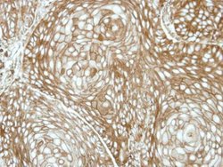 Invitrogen RDH5 Polyclonal Antibody 100 &mu;L; Unconjugated:Antibodies,