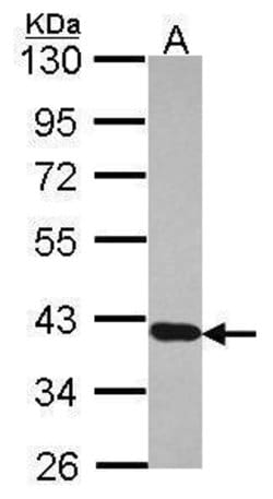 Invitrogen RDH5 Polyclonal Antibody 100 &mu;L; Unconjugated:Antibodies,