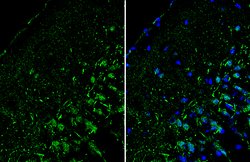 Invitrogen RORB Polyclonal Antibody 100 &mu;L; Unconjugated:Antibodies,