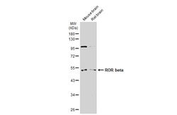 Invitrogen RORB Polyclonal Antibody 100 &mu;L; Unconjugated:Antibodies,